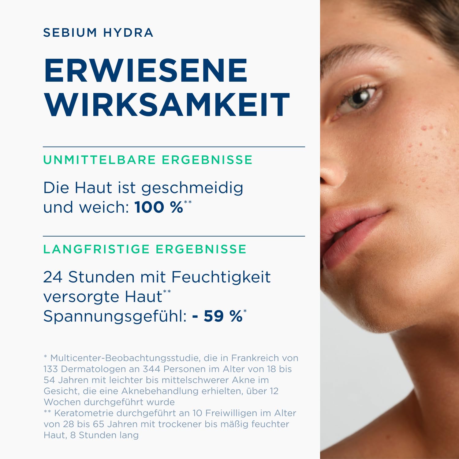 Bioderma Sébium Hydra Ultra-Moisturising Feuchtigkeitscreme