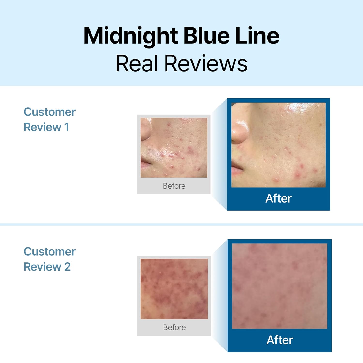 Dear Klairs Midnight Blue Calming Cream