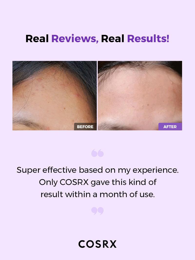 COSRX AHA/ BHA Clarifying Treatment Toner